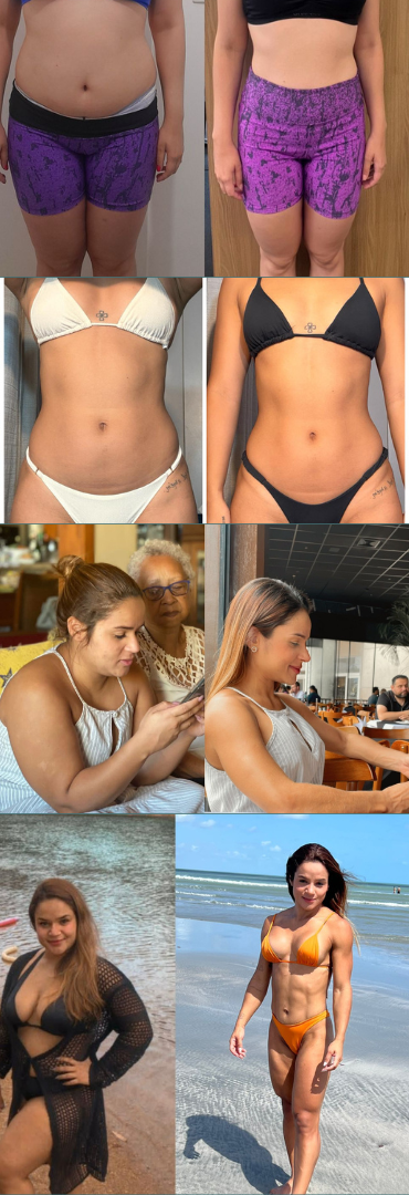 Thumb lateral mobile