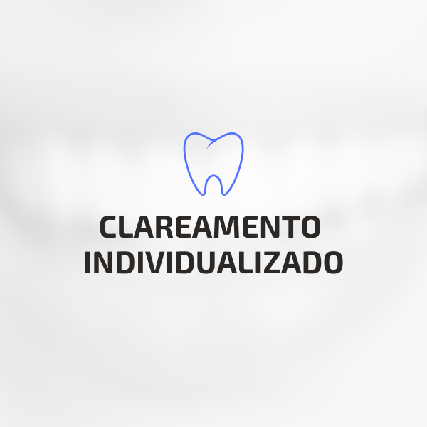 Clareamento sem sensibilidade 