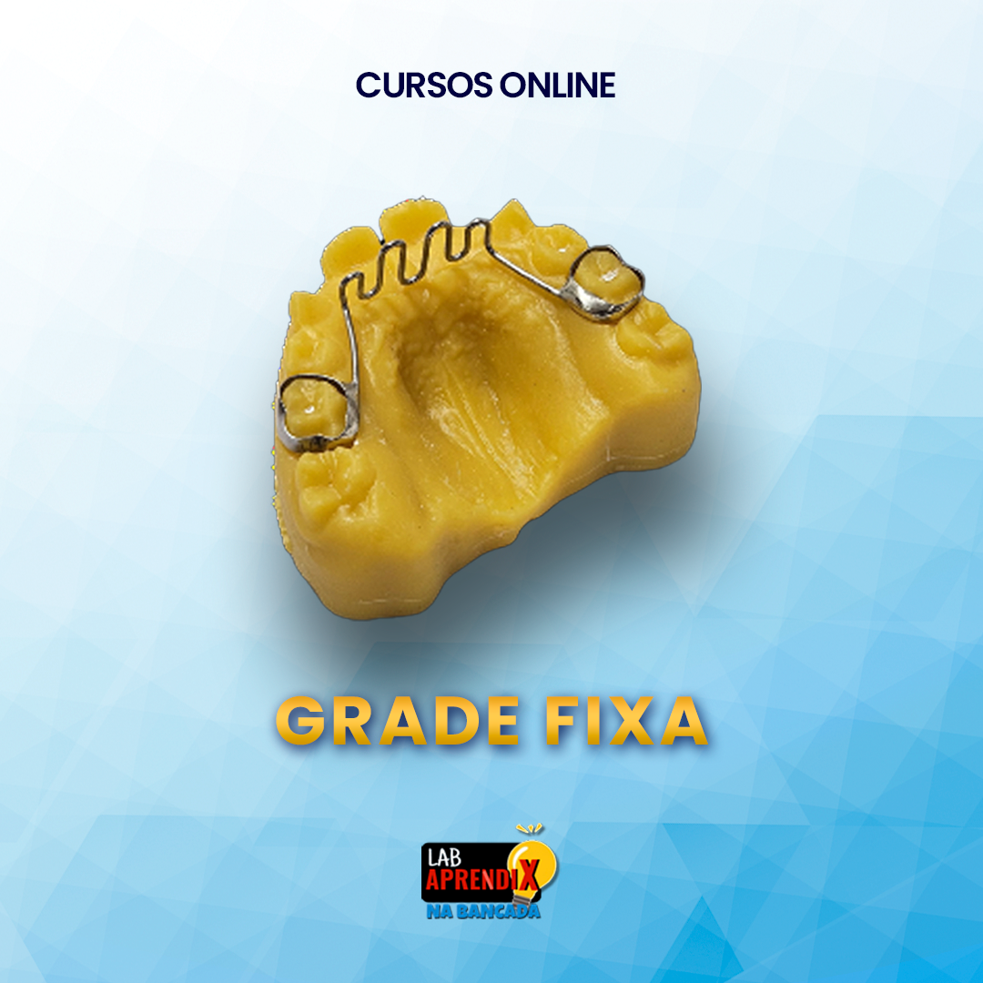 Grade Fixa - Na Bancada