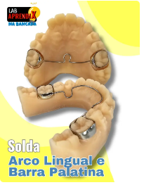 Arco Lingual e Barra Palatina - Na Bancada
