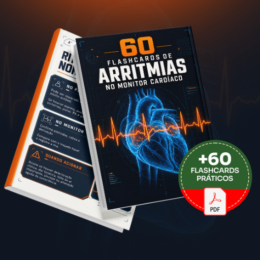 60 Flashcards de Arritmias no Monitor Cardíaco - Básico