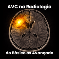 AVC na Radiologia - Do Básico ao Avançado 2025