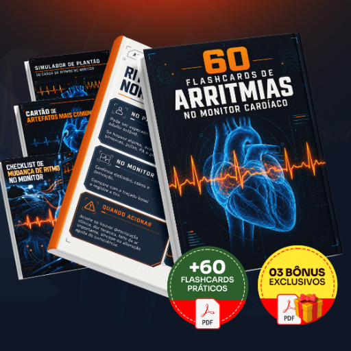 60 Flashcards de Arritmias no Monitor Cardíaco - Completo