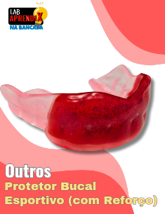 Protetor Bucal Esportivo (com reforço) - Na Bancada