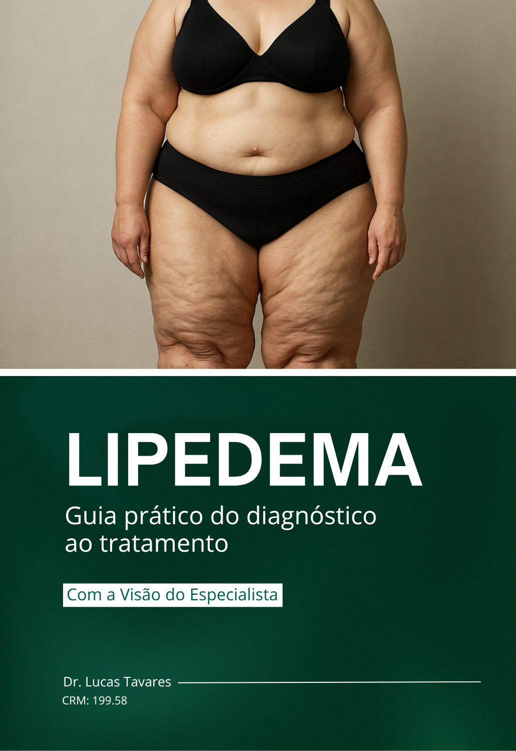 Guia Prático Lipedema