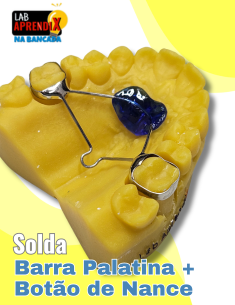 Barra Palatina e Botão de Nance - Na Bancada