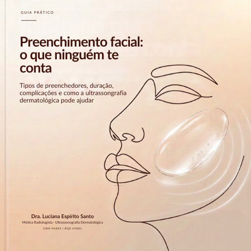 Preenchimento facil: o que ninguém te conta.