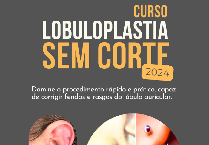 Lobuloplastia sem Corte